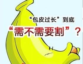 5-140RQ60T15N 5-140RQ60T15N