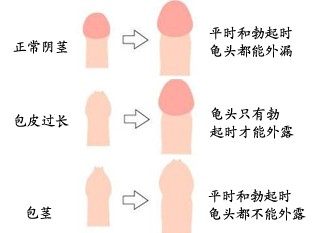 5-14092011055SS 5-14092011055SS